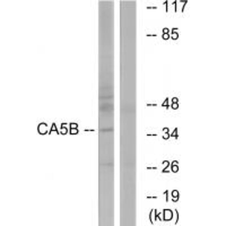 Western blot - CA5B Antibody from Signalway Antibody (34542) - Antibodies.com