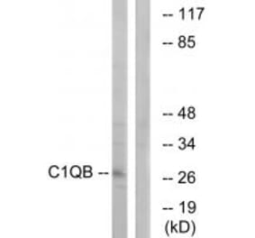 Western blot - C1QB Antibody from Signalway Antibody (34607) - Antibodies.com