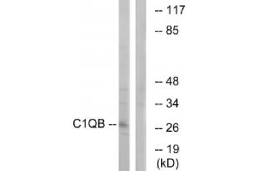 Western blot - C1QB Antibody from Signalway Antibody (34607) - Antibodies.com