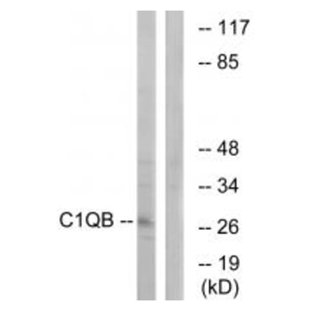 Western blot - C1QB Antibody from Signalway Antibody (34607) - Antibodies.com