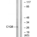 Western blot - C1QB Antibody from Signalway Antibody (34607) - Antibodies.com