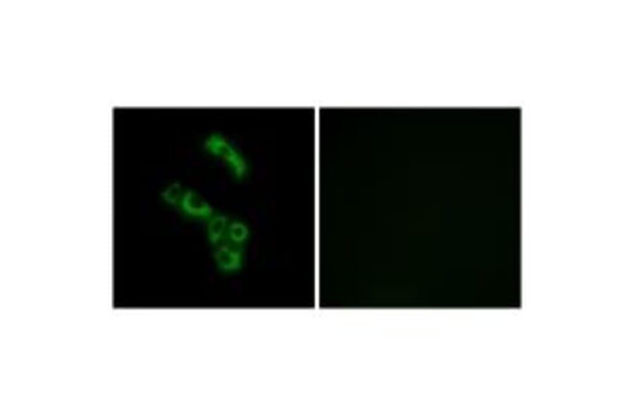 Immunofluorescence - C1QB Antibody from Signalway Antibody (34607) - Antibodies.com