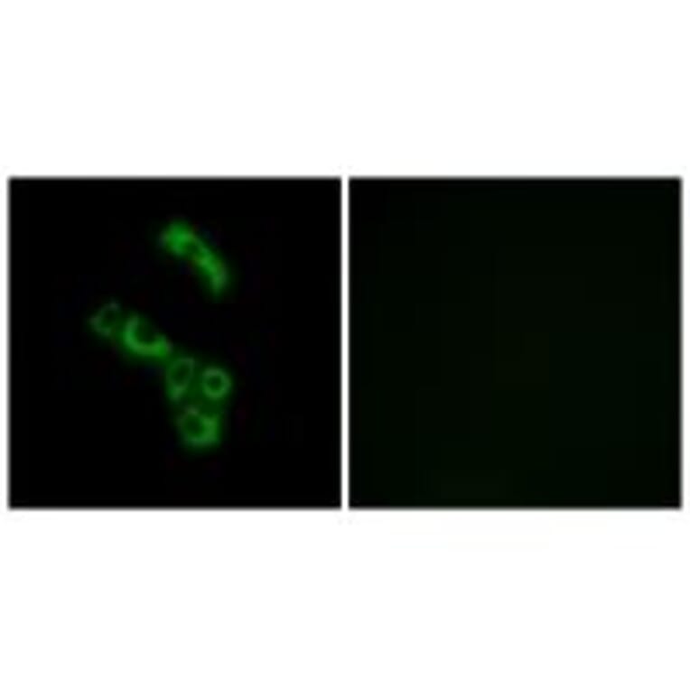 Immunofluorescence - C1QB Antibody from Signalway Antibody (34607) - Antibodies.com