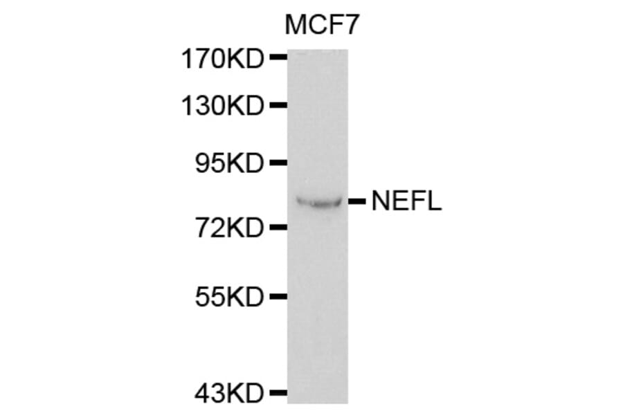 Western blot - NEFL antibody from Signalway Antibody (38115) - Antibodies.com