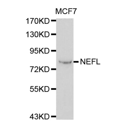 Western blot - NEFL antibody from Signalway Antibody (38115) - Antibodies.com