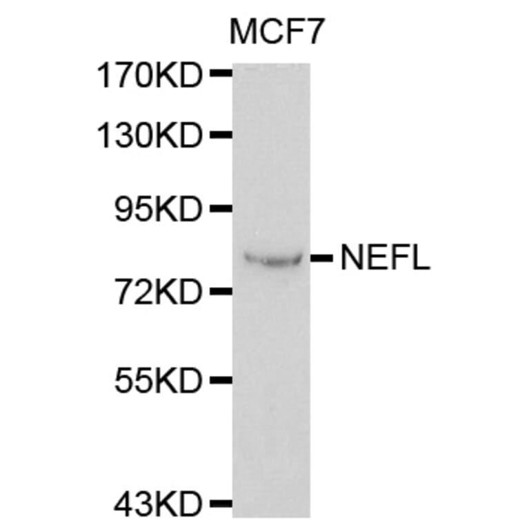 Western blot - NEFL antibody from Signalway Antibody (38115) - Antibodies.com