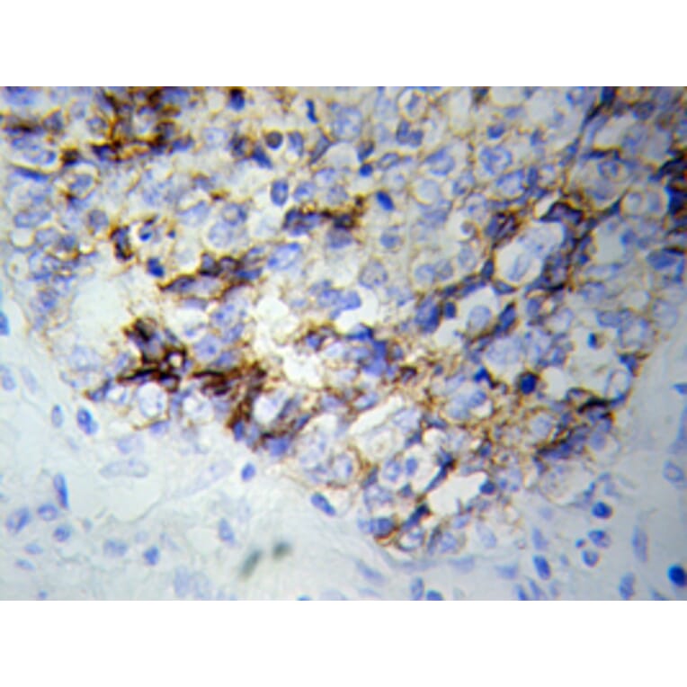 Immunohistochemistry - NEFL antibody from Signalway Antibody (38115) - Antibodies.com