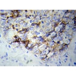 Immunohistochemistry - NEFL antibody from Signalway Antibody (38115) - Antibodies.com