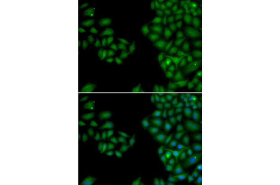 Immunofluorescence - NEFL antibody from Signalway Antibody (38115) - Antibodies.com