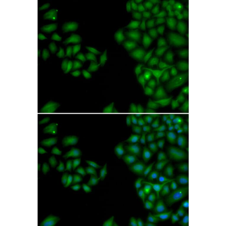 Immunofluorescence - NEFL antibody from Signalway Antibody (38115) - Antibodies.com