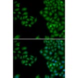 Immunofluorescence - NEFL antibody from Signalway Antibody (38115) - Antibodies.com