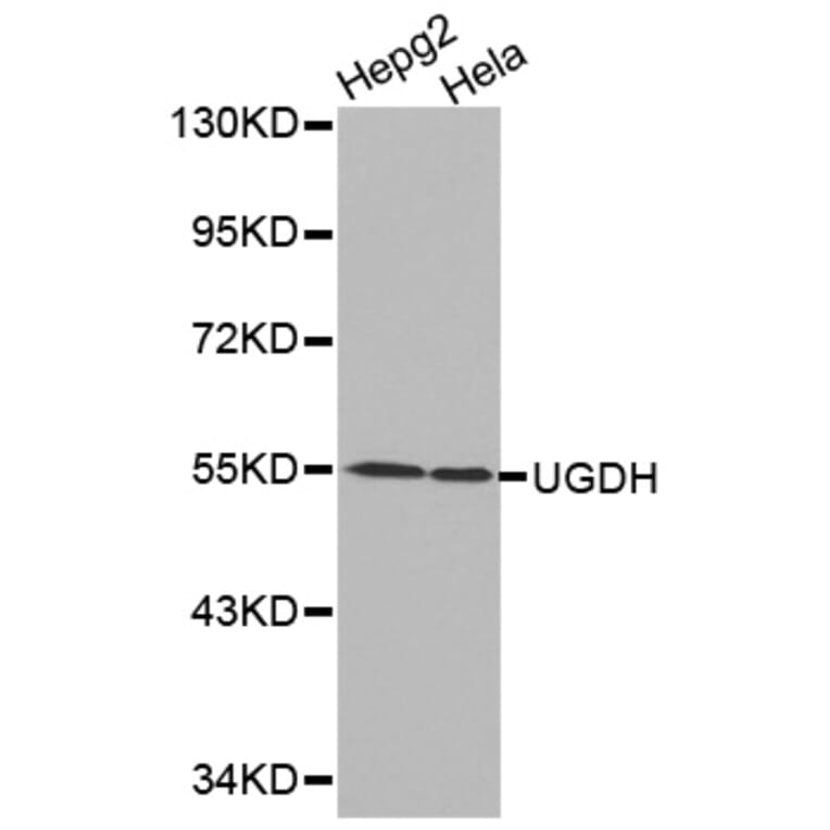 Western blot - UGDH antibody from Signalway Antibody (38217) - Antibodies.com