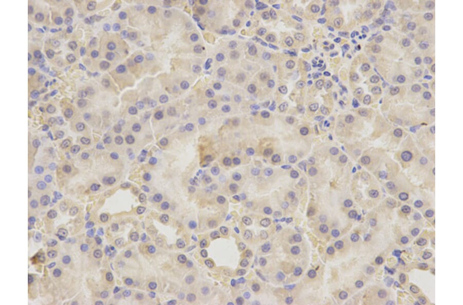 Immunohistochemistry - UGDH antibody from Signalway Antibody (38217) - Antibodies.com