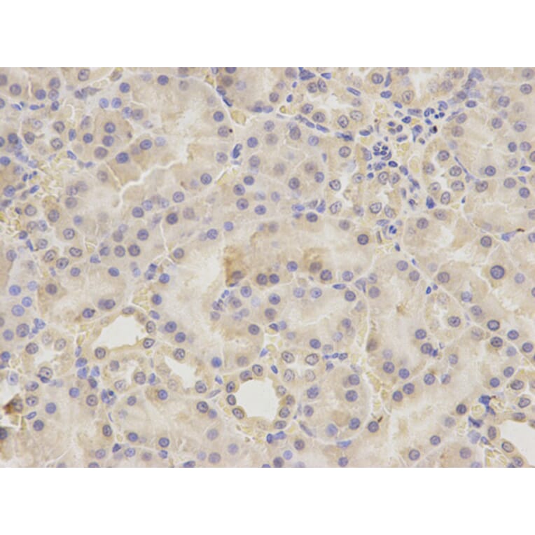Immunohistochemistry - UGDH antibody from Signalway Antibody (38217) - Antibodies.com