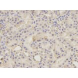 Immunohistochemistry - UGDH antibody from Signalway Antibody (38217) - Antibodies.com