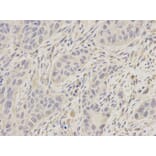 Immunohistochemistry - UGDH antibody from Signalway Antibody (38217) - Antibodies.com