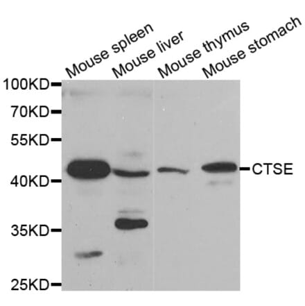 Western blot - CTSE antibody from Signalway Antibody (38438) - Antibodies.com