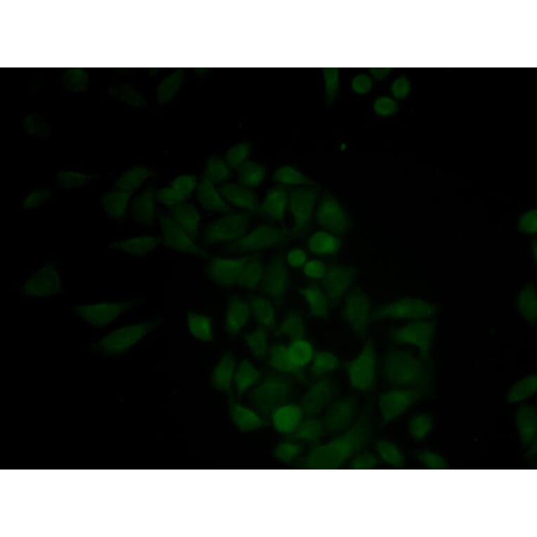 Immunofluorescence - CTSE antibody from Signalway Antibody (38438) - Antibodies.com