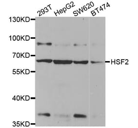 Western blot - HSF2 antibody from Signalway Antibody (38456) - Antibodies.com
