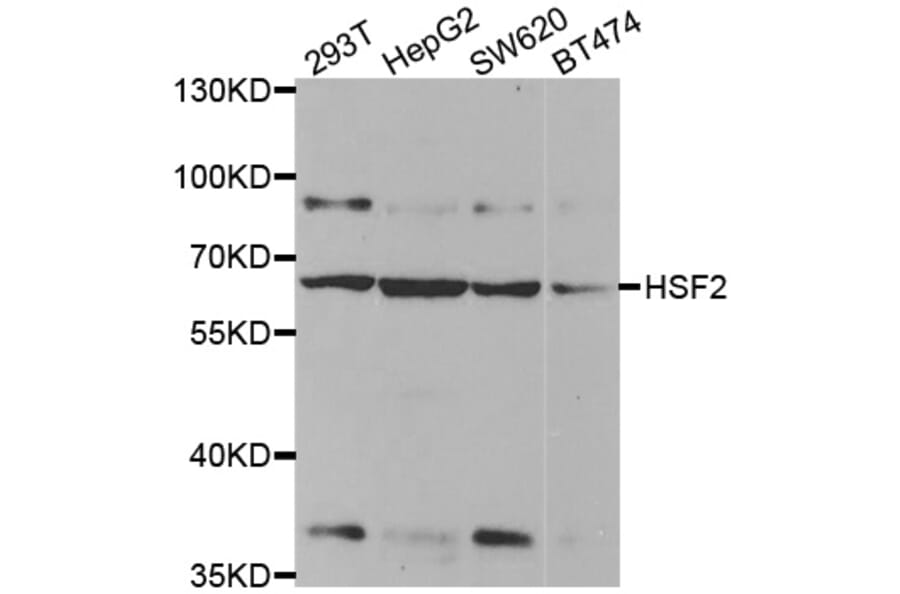 Western blot - HSF2 antibody from Signalway Antibody (38456) - Antibodies.com
