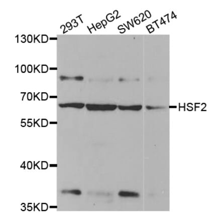 Western blot - HSF2 antibody from Signalway Antibody (38456) - Antibodies.com