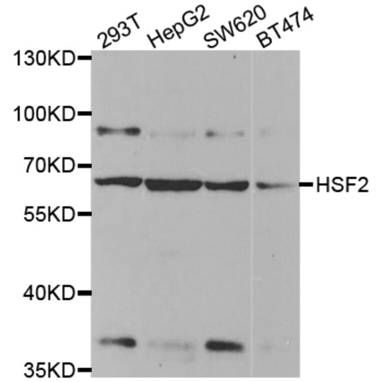 Western blot - HSF2 antibody from Signalway Antibody (38456) - Antibodies.com