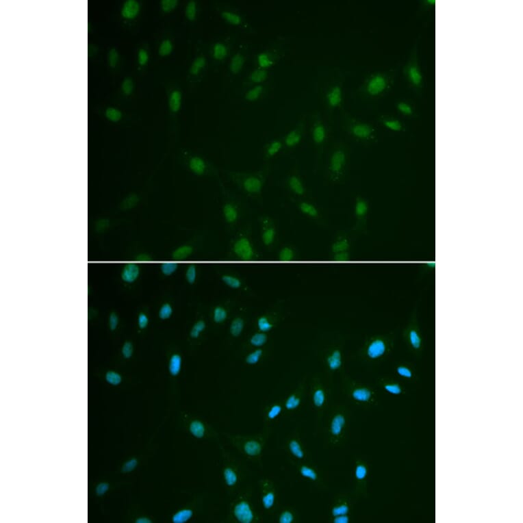 Immunofluorescence - HSF2 antibody from Signalway Antibody (38456) - Antibodies.com