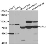 Western blot - CPT2 antibody from Signalway Antibody (38474) - Antibodies.com