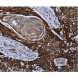 Immunohistochemistry - CPT2 antibody from Signalway Antibody (38474) - Antibodies.com