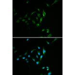 Immunofluorescence - CPT2 antibody from Signalway Antibody (38474) - Antibodies.com
