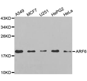 Western blot - ARF6 antibody from Signalway Antibody (38605) - Antibodies.com