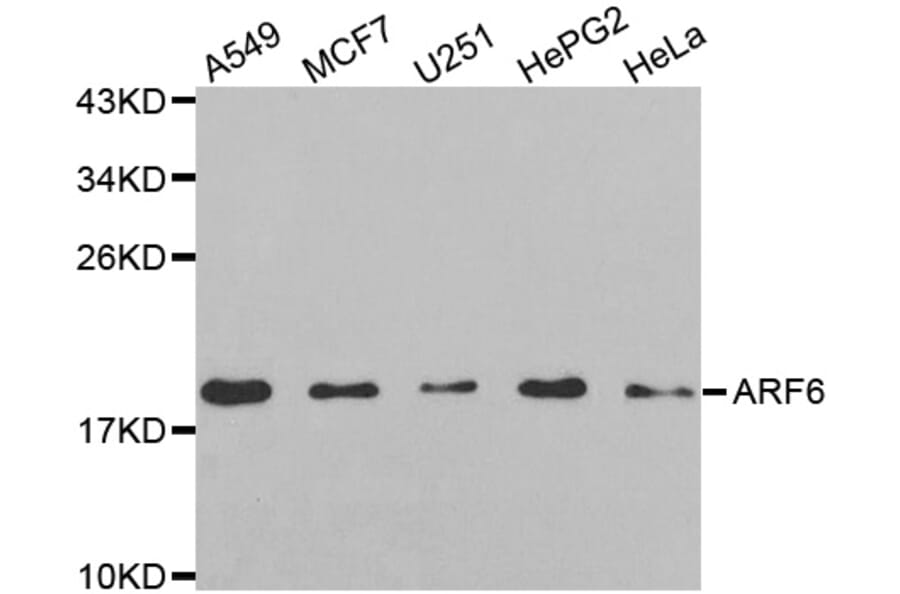 Western blot - ARF6 antibody from Signalway Antibody (38605) - Antibodies.com