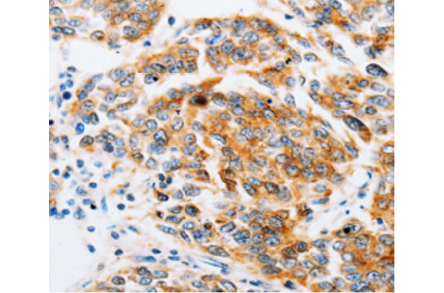 Immunohistochemistry - ARF6 antibody from Signalway Antibody (38605) - Antibodies.com