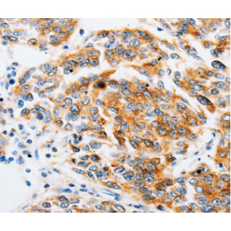 Immunohistochemistry - ARF6 antibody from Signalway Antibody (38605) - Antibodies.com