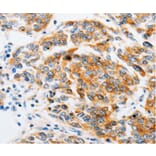 Immunohistochemistry - ARF6 antibody from Signalway Antibody (38605) - Antibodies.com