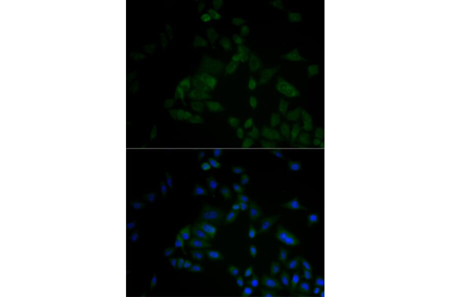 Immunofluorescence - ARF6 antibody from Signalway Antibody (38605) - Antibodies.com