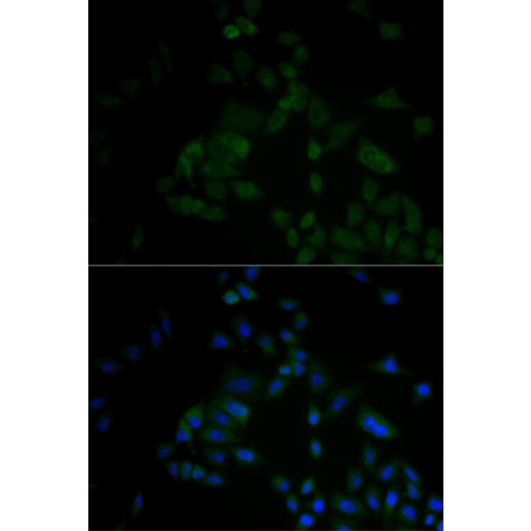 Immunofluorescence - ARF6 antibody from Signalway Antibody (38605) - Antibodies.com