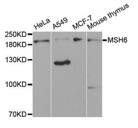Western blot - MSH6 antibody from Signalway Antibody (38618) - Antibodies.com