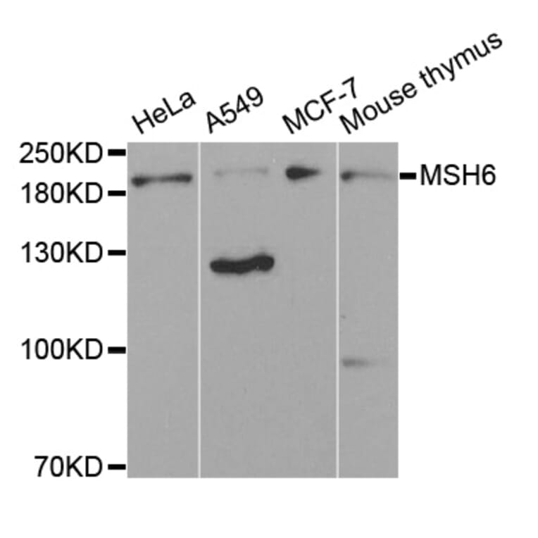 Western blot - MSH6 antibody from Signalway Antibody (38618) - Antibodies.com