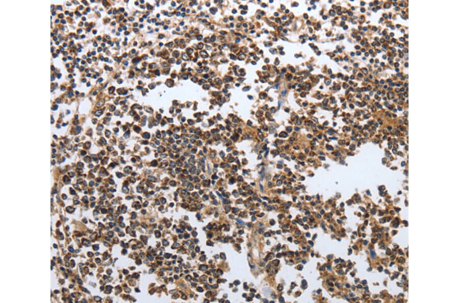 Immunohistochemistry - MSH6 antibody from Signalway Antibody (38618) - Antibodies.com