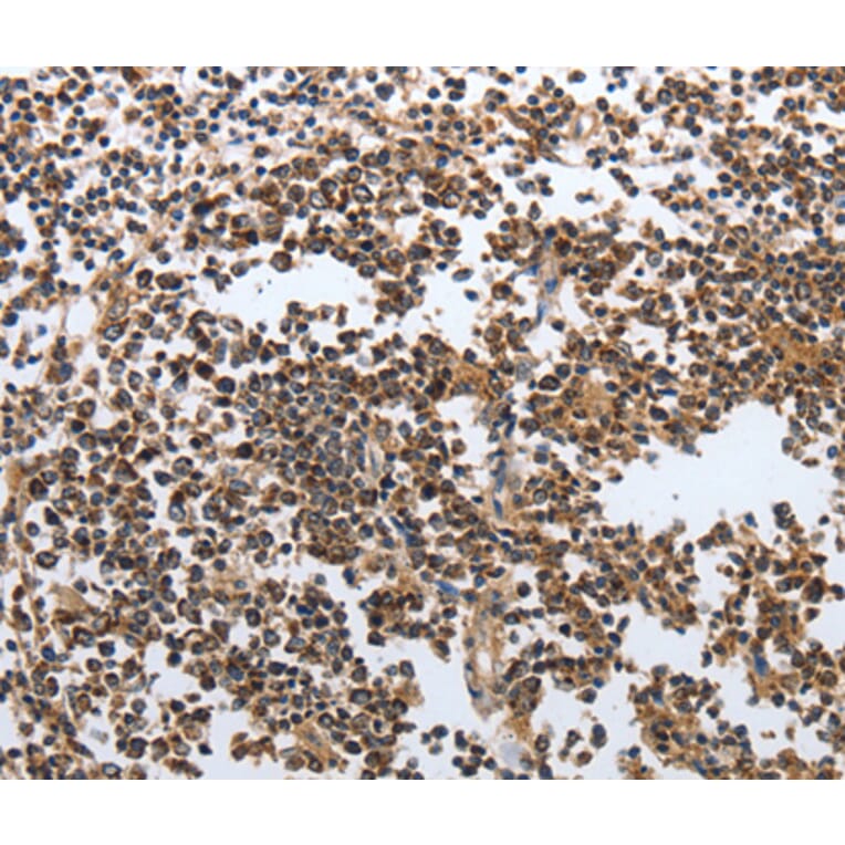 Immunohistochemistry - MSH6 antibody from Signalway Antibody (38618) - Antibodies.com