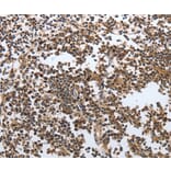 Immunohistochemistry - MSH6 antibody from Signalway Antibody (38618) - Antibodies.com
