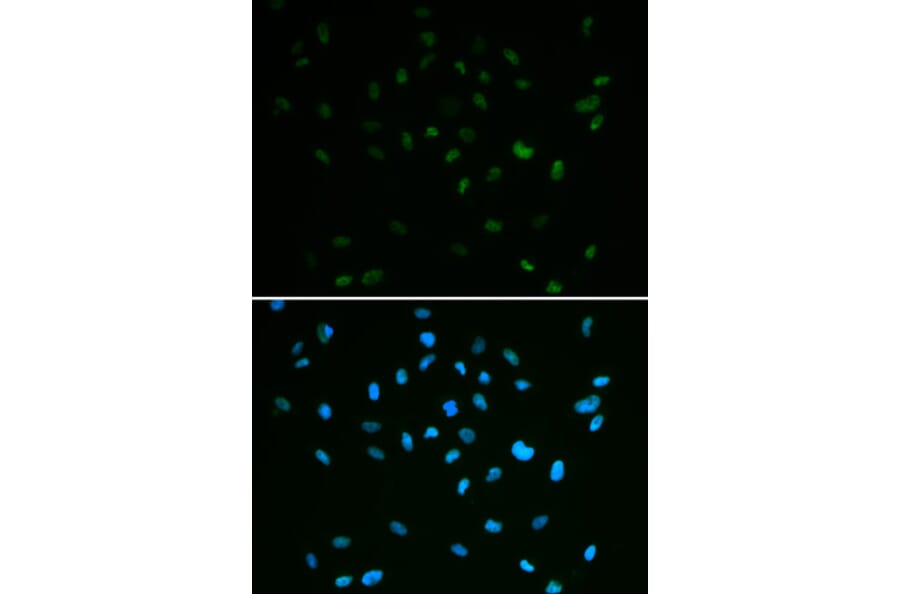 Immunofluorescence - MSH6 antibody from Signalway Antibody (38618) - Antibodies.com