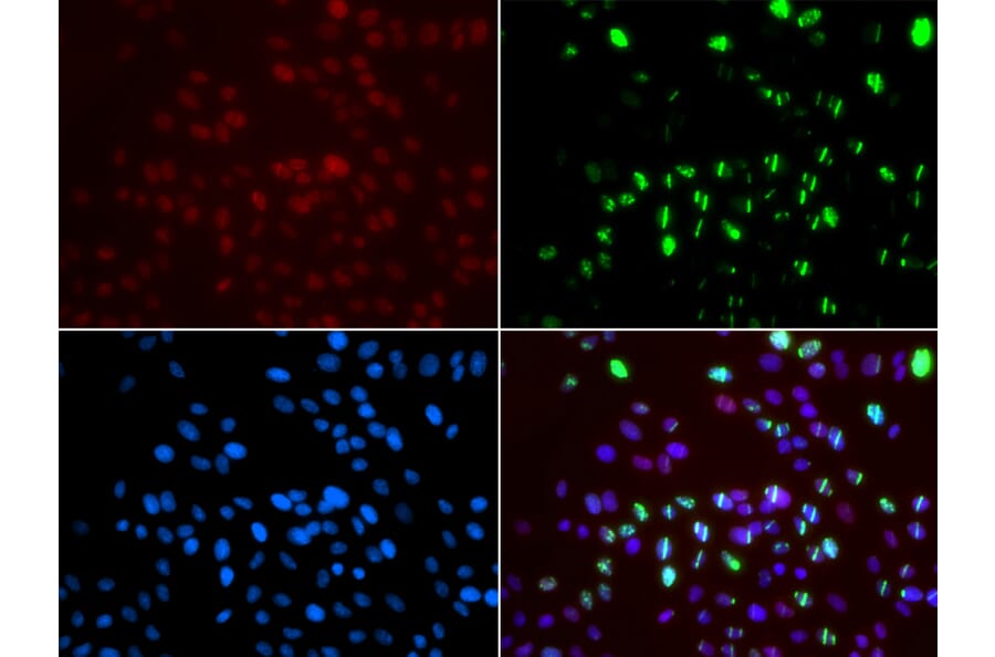 Immunofluorescence - MSH6 antibody from Signalway Antibody (38618) - Antibodies.com
