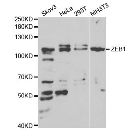 Western blot - ZEB1 antibody from Signalway Antibody (38675) - Antibodies.com