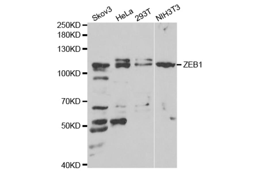 Western blot - ZEB1 antibody from Signalway Antibody (38675) - Antibodies.com