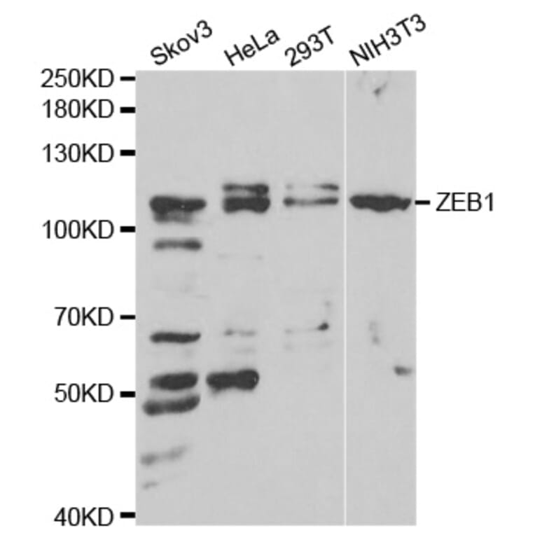 Western blot - ZEB1 antibody from Signalway Antibody (38675) - Antibodies.com