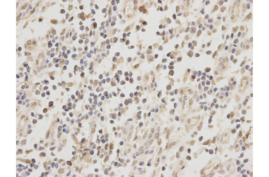 Immunohistochemistry - ZEB1 antibody from Signalway Antibody (38675) - Antibodies.com
