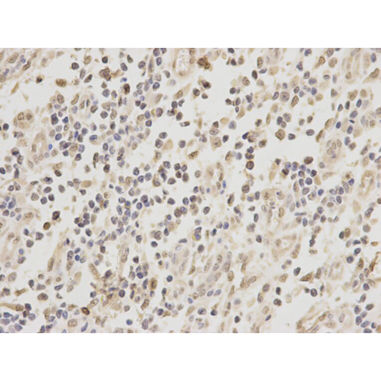 Immunohistochemistry - ZEB1 antibody from Signalway Antibody (38675) - Antibodies.com