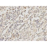 Immunohistochemistry - ZEB1 antibody from Signalway Antibody (38675) - Antibodies.com
